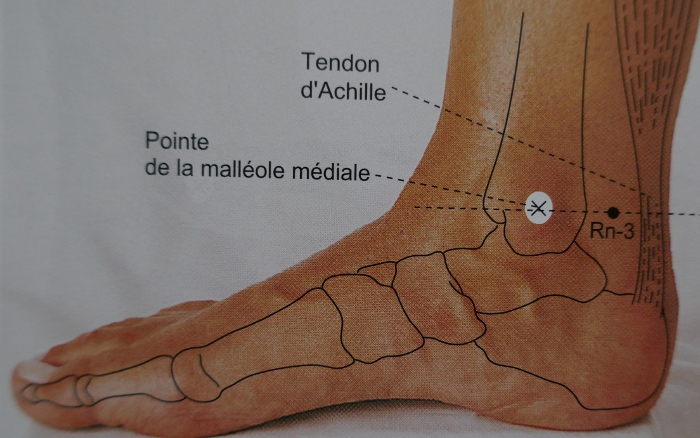 R3 Taixi malléole, tendon d'Achille
